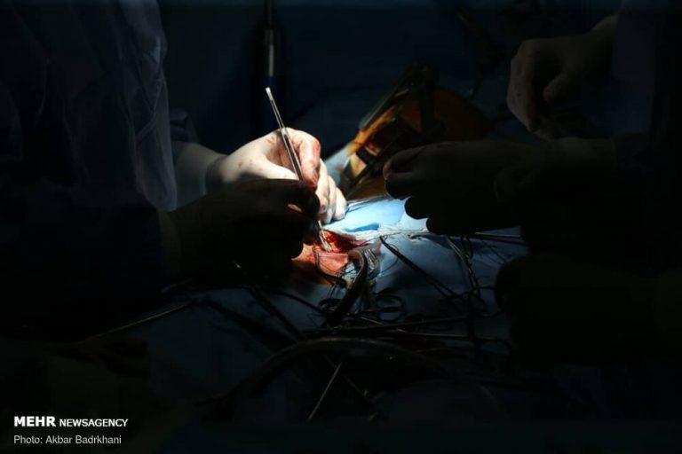 افزایش طول عمر دریچههای بیولوژیکی قلب ممکن شد