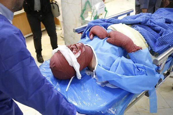 چهارشنبه آخر سال در اردبیل ۶۸ مصدوم و ۲ قطع عضو داشت